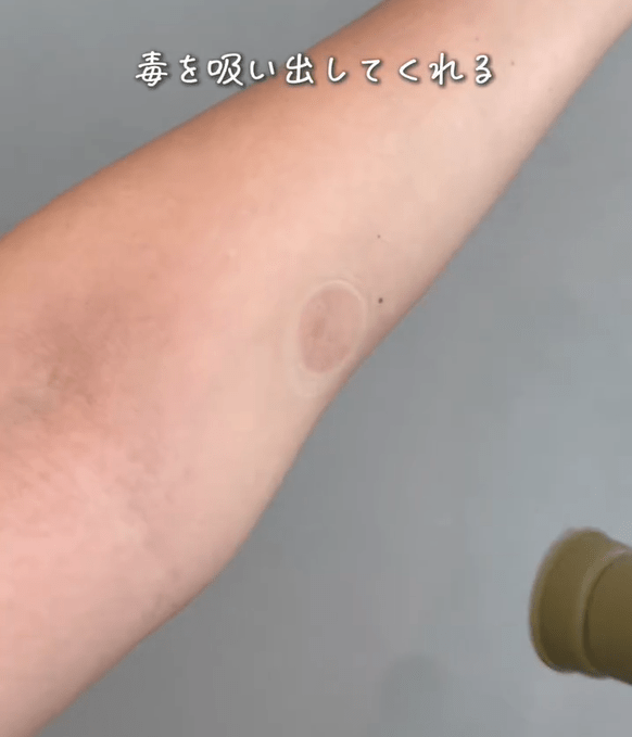重复使用几次，以吸出蚊毒（图：yumiyu_kurashi@IG）