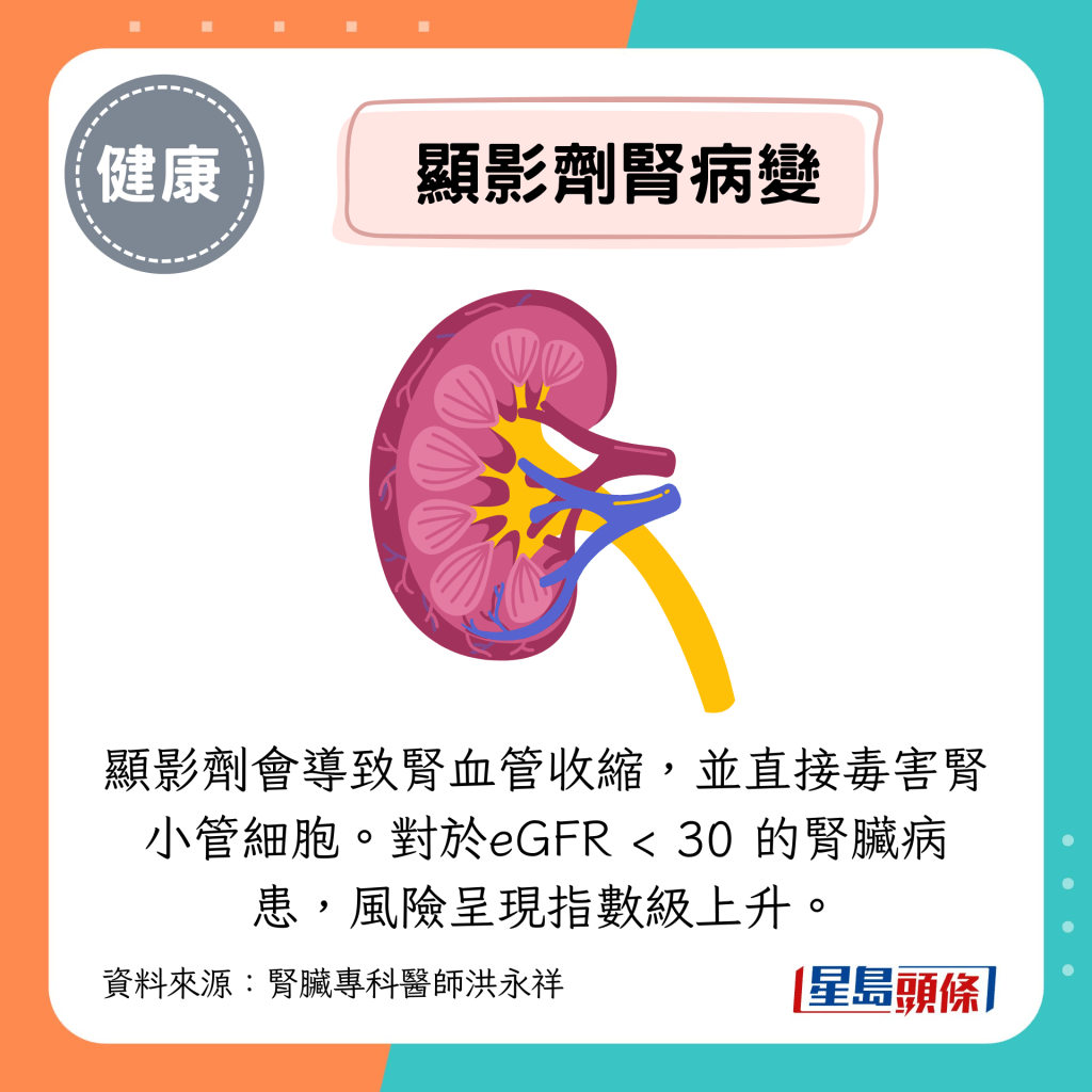 显影剂会导致肾血管收缩，并直接毒害肾小管细胞。对于eGFR < 30 的肾脏病患，风险呈现指数级上升。