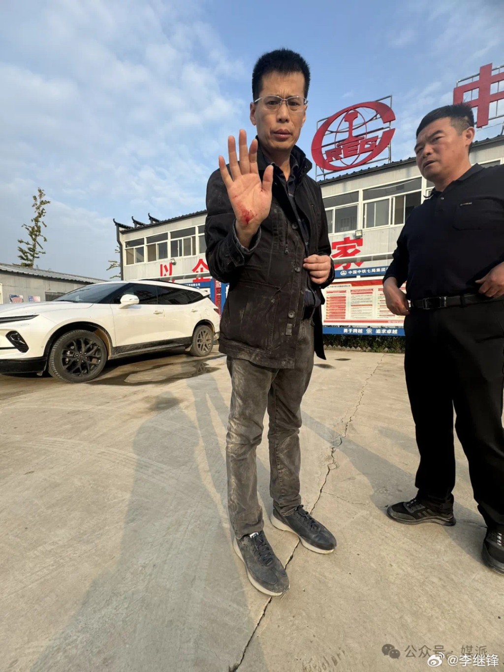 王文志右手受伤流血。(微博) 王文志右手受伤流血。(微博)