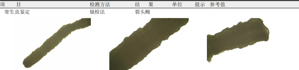 医院寄生虫鉴定。 医院寄生虫鉴定。